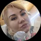 Альбина
